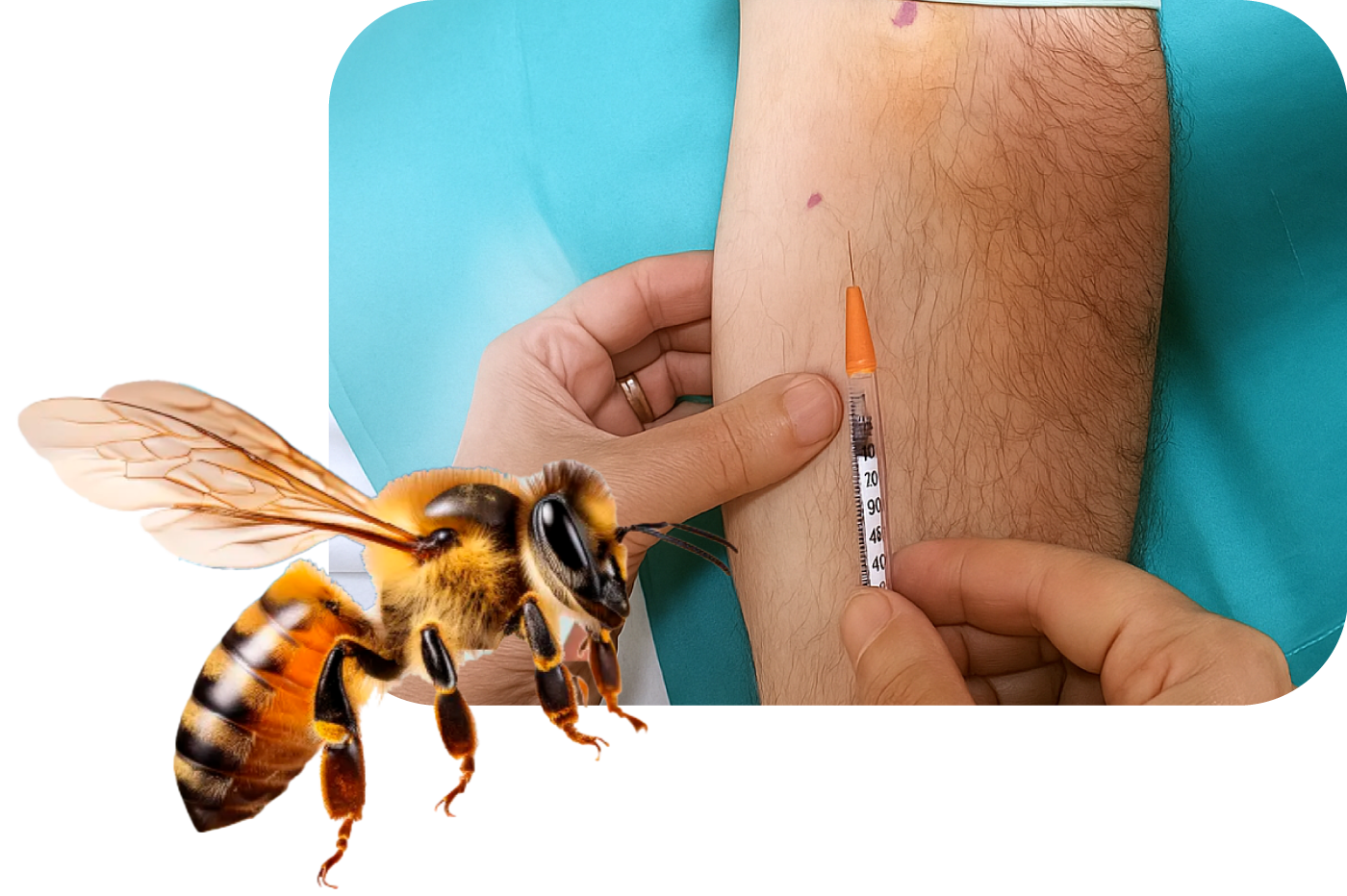 DIATER: Test intradérmicos de venenos